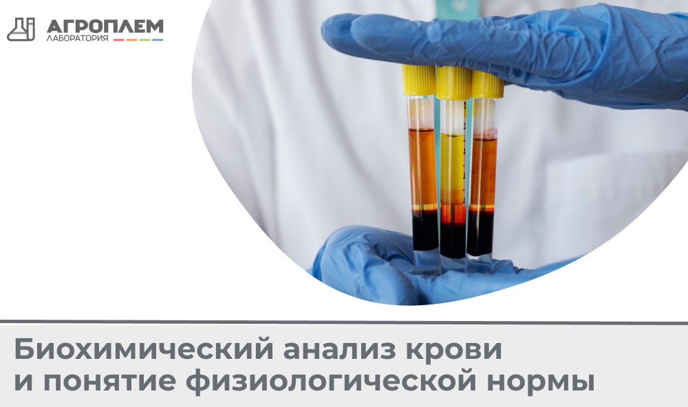 Биохимический анализ крови и понятие физиологической нормы